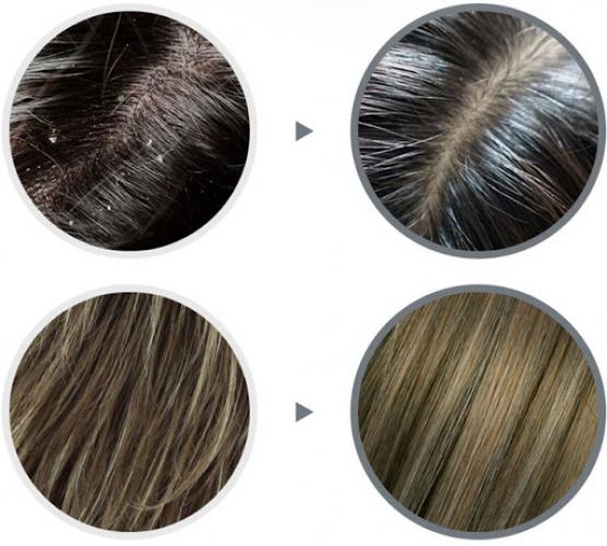 Шампунь против перхоти LA'DOR ANTI-DANDRUFF SHAMPOO 530мл